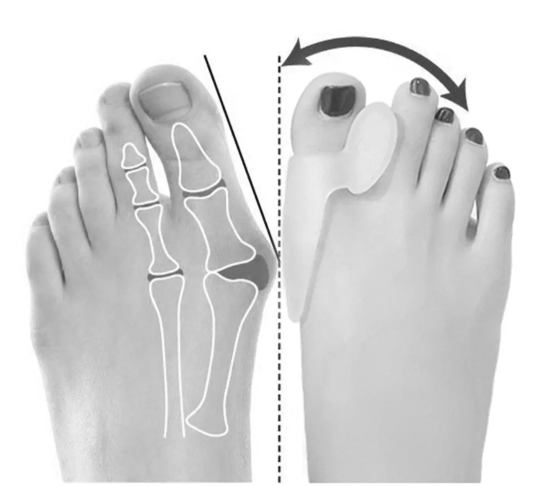 Deez Silicone Toe Separator